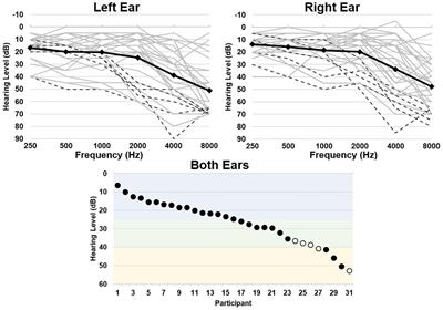 Functional Connectivity of Heschl’s Gyrus Associated With Age-Related Hearing Loss: A Resting-State fMRI Study